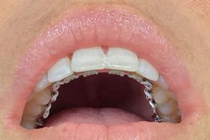 clinicas ortodoncia valparaiso Dental Style
